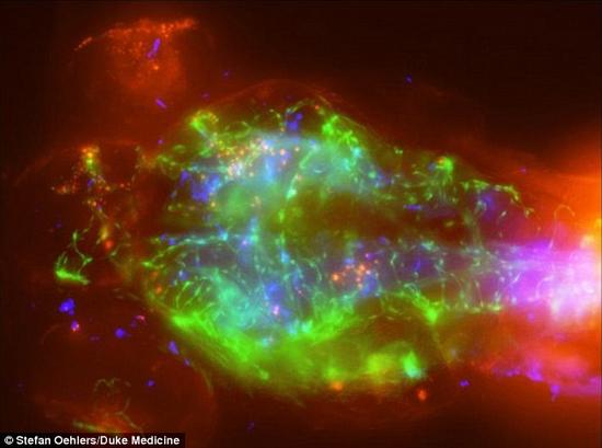 最后得到的图像看上去像是太空中的旋转星系。但实际上，这一发现对击溃脑膜炎这一每年导致60万人身亡的疾病可能具有巨大的价值。