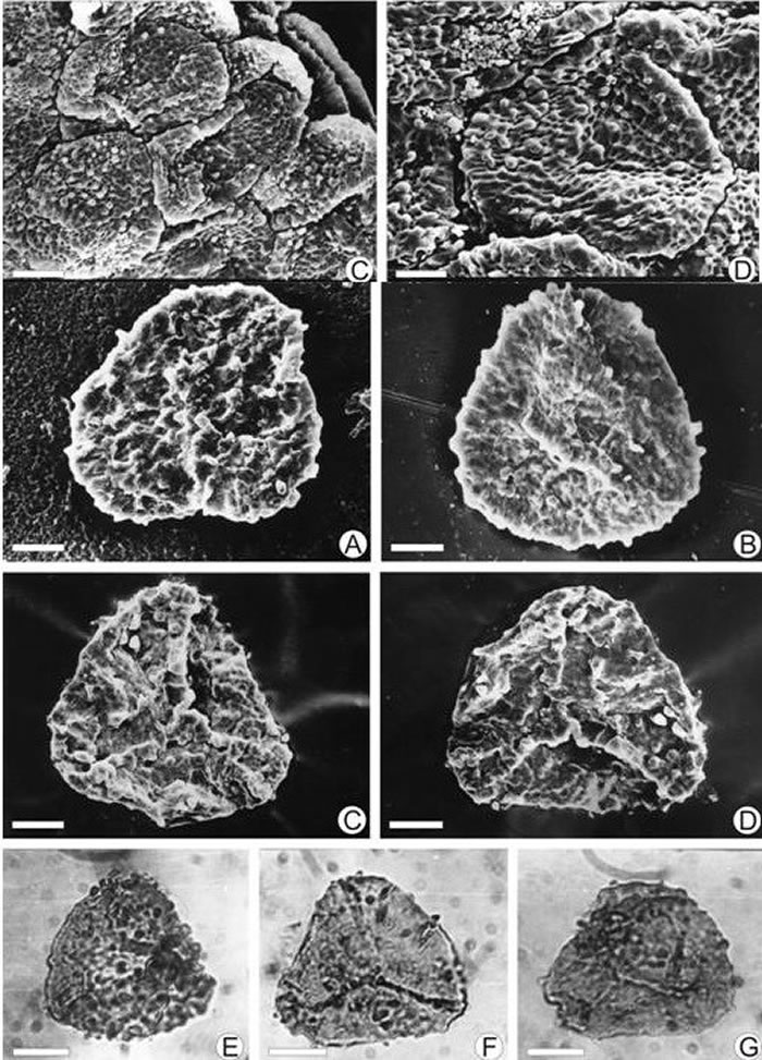 倒卵形格子蕨（Clathropteris obovata）孢子囊和原位孢子特征