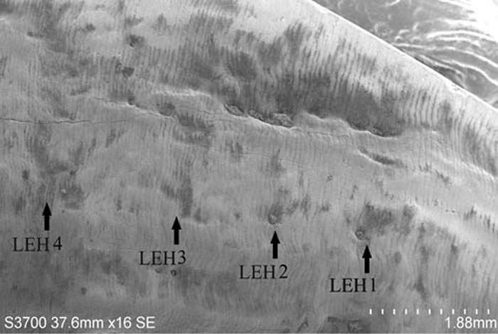 扫描电镜下的牙齿釉面横纹和釉质发育不全现象（LEH）（王翠斌供图）