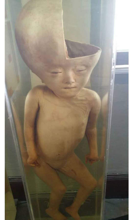 【阅览注意】泰国《死亡博物馆》沉睡着所有奇异的标本 - 图片6