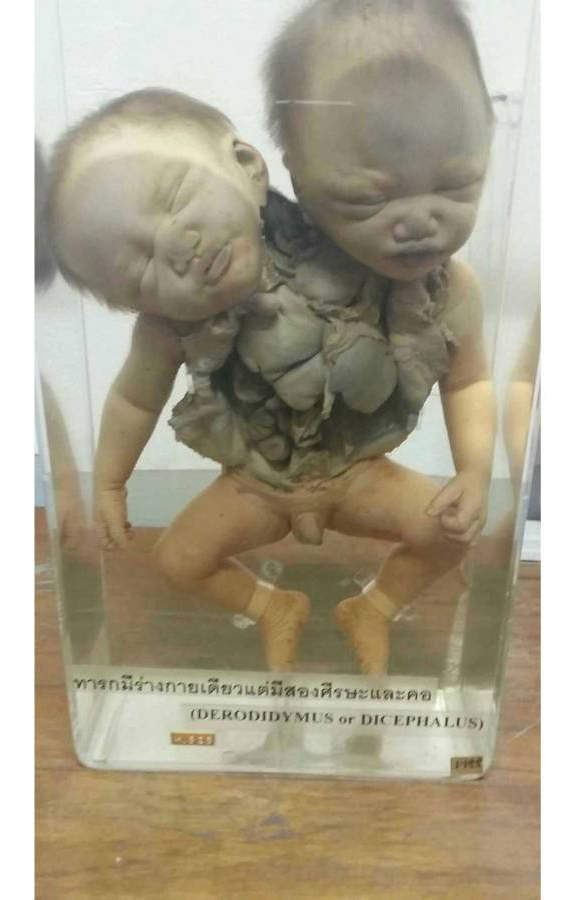 【阅览注意】泰国《死亡博物馆》沉睡着所有奇异的标本 - 图片5