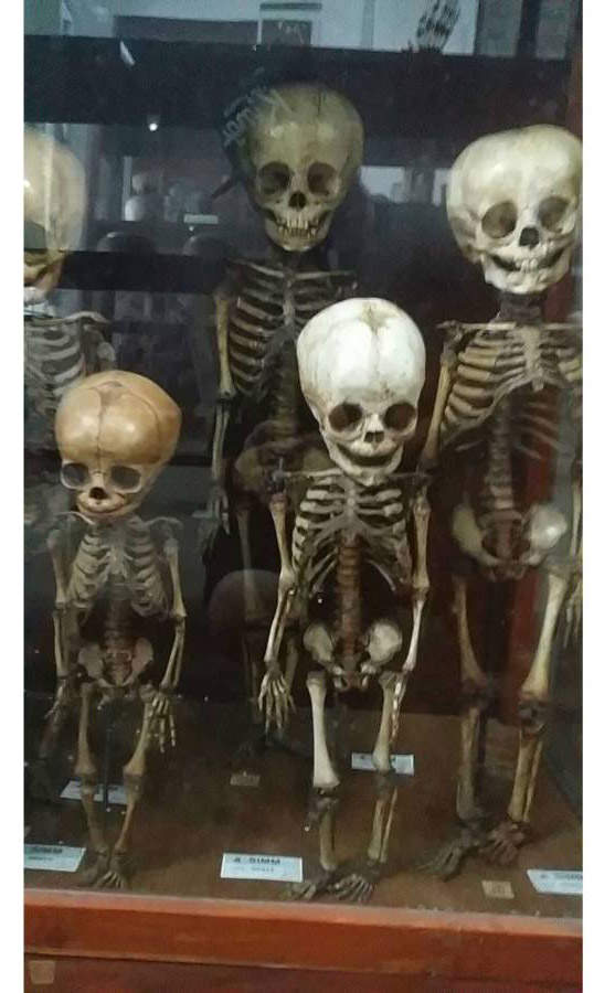 【阅览注意】泰国《死亡博物馆》沉睡着所有奇异的标本 - 图片2