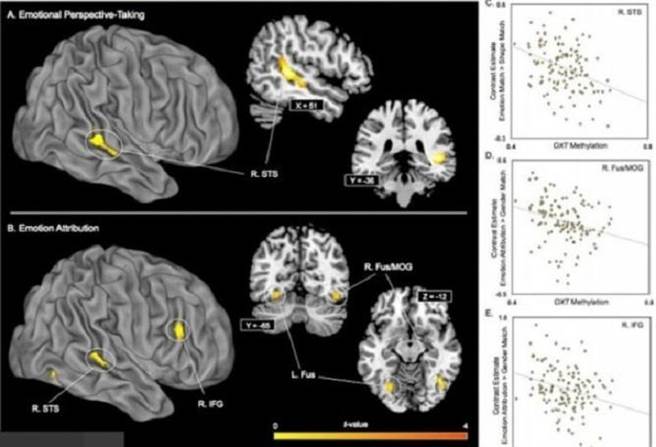 专家用功能性磁振造影检视研究对象的脑部活动。