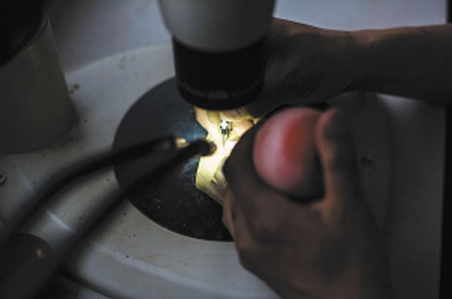 采集来的古生物化石，需要在显微镜下小心谨慎地修复