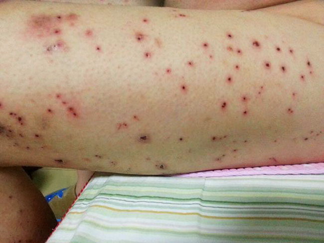 54fbb2fb43166d227050d7d4442309f79052d24f