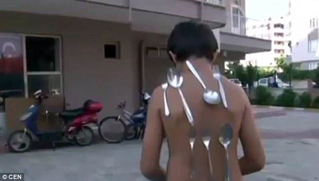 真人万磁王！男孩身体可吸附金属 越生气越强