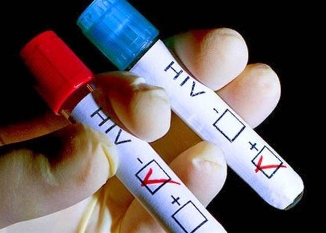 别怕！专家：这项治疗可保爱滋病毒不传伴侣