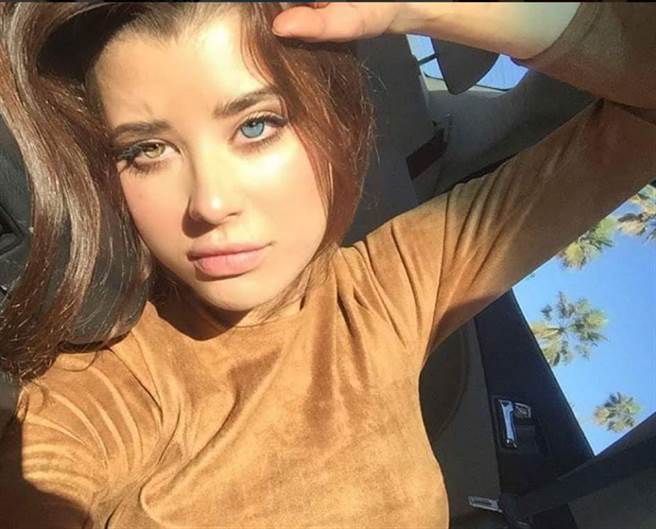 莎拉(Sarah McDaniel)患有虹膜异色症(Heterochromia)