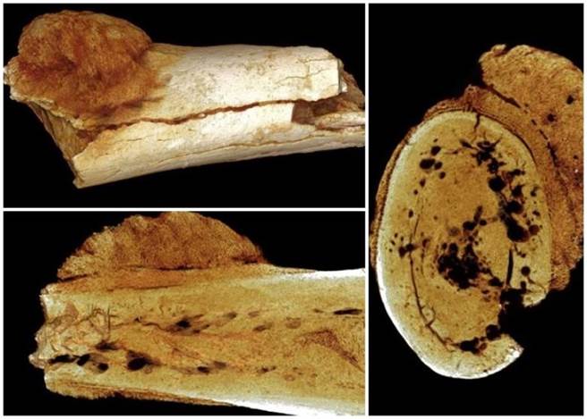科学家在该块脚骨上发现骨癌痕迹（东网）