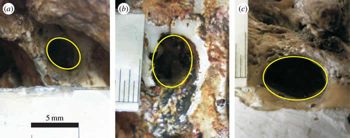 脑洞大开：人类头颅中让两条主动脉通往大脑的洞300万年来扩大了6倍