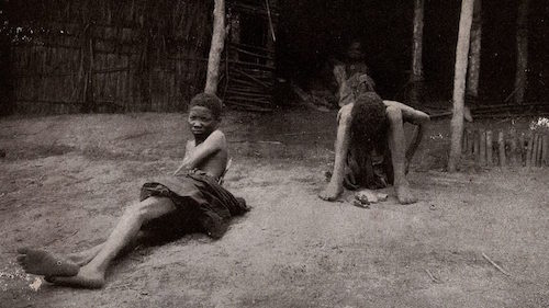 图片来源：Wellcome Images/Wikimedia Commons