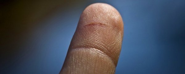 被纸割伤为何这么疼？