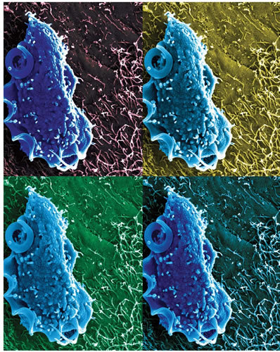 小鼠三毛滴虫电子显微镜扫描图。图片来源：Chudnovskiy Merad
