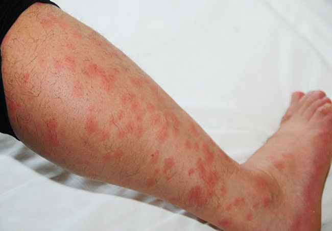 002tXfG8gy6Lp3ylJ8Sb2&690