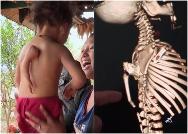 阿鲁姆（左图左）背部长有第三只手。