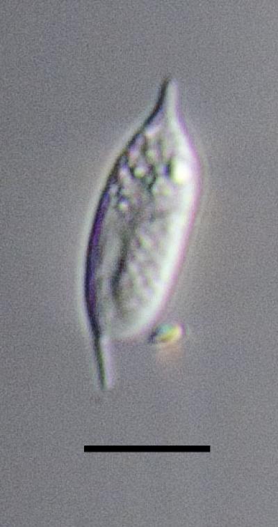 研究人员首次直接观察到Diplonemid。图片来源：PATRICK KEELING