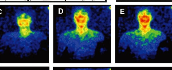 人类也能发光，只是肉眼看不见而已
