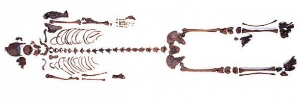 沼泽木乃伊：是失踪女孩还是古代女尸？