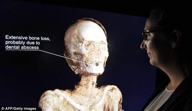 英国首次扫描埃及木乃伊 揭开3000年秘密