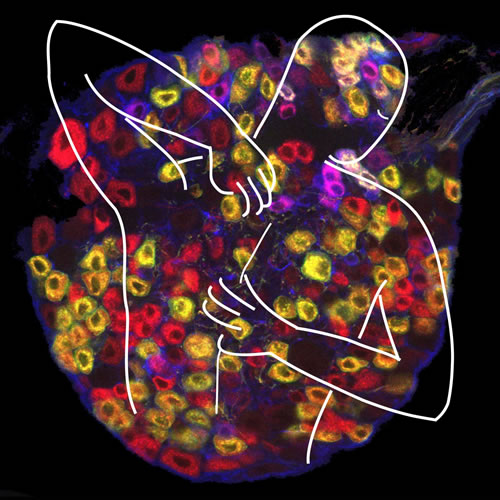 图片来源：董欣中等