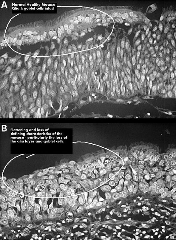 空鼻症是怎么回事？